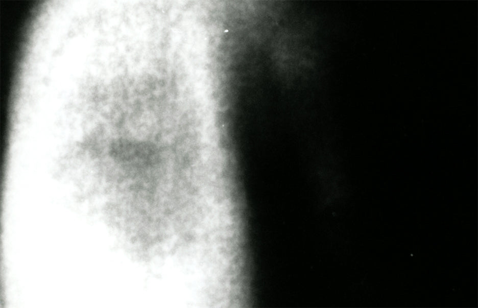 Portrait Grotesque (8x10" Silver Gelatin Print)